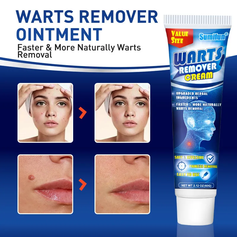 Sumifun   Wart Cream Wart Ointment Wart Wart Flat Chicken Eye Ointment Flat Wart Wart Skin Cream display picture 2